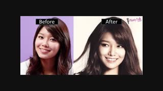 اعضای زشت گرلز جنریشن قبل از عمل جراحی