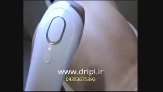 دستگاه ای پی ال رفع موهای زاید-هوشمند