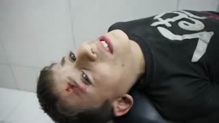 اینجا آخر دنیا و پایان انسانیت است...بیمارستان حلب سوریه