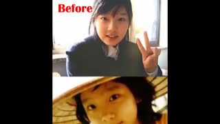 20ایدال های برتر کره ای قبل و بعد از عمل جراحی