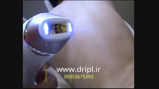 دستگاه لیزر موهای زائد سالنی