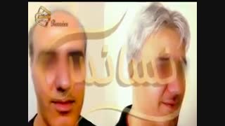 ترمیم مو به روش اختصاصی HRT مرکز تخصصی موی رنسانس