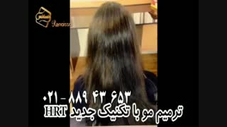 ترمیم مو به روش اختصاصی HRT مرکز تخصصی موی رنسانس