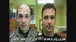 ترمیم مو به روش اختصاصی HRT مرکز تخصصی موی رنسانس