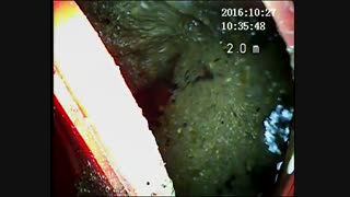 ویدئومتری پوش راد