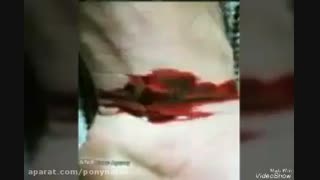دعا کنید ممنون میشم