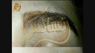 کاشت ابرو طبیعی با روش SUT مرکز کاشت ابرو و مژه