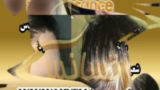 کاشت مو طبیعی با روش SUT مرکز کاشت و پیوند مو