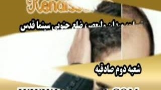 ترمیم مو با تکنیک استاندارد و انحصاری HRT مرکز مو رنسانس