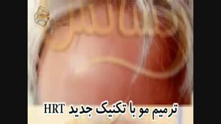 ترمیم مو به روش اختصاصی HRT مرکز تخصصی موی رنسانس