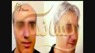 ترمیم مو به روش اختصاصی HRT مرکز تخصصی موی رنسانس