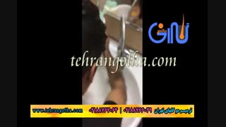ترمیم مو گلهای تهران - کاشت مو - روش های فیکس آلمان