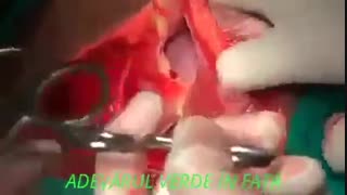 عمل زایمان