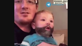 آخی ریشش کنده شد!!!!!!