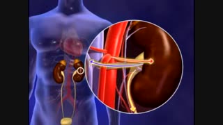 پاتو فیزیو لوژی دیابت