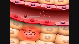 اثرات هایپرگلیسمیا بر سیستم ایمنی