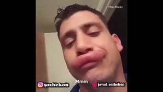 سوژه: لب پروتزی این آقا ! همین کم بود :)