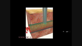 اهدای پلاگت