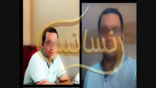 کاشت مو به روشSUT مرکز مو رنسانس