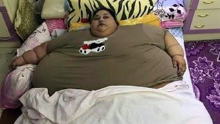 زن 500 کیلوگرمی کارش به جراحی کشید