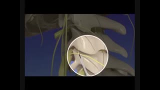 علل درد گردن - دکتر علی نقره کار