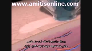 دانش و تکنولوژی بکار رفته در میکرودرم ابریژن خانگیPMD ( زیرنویس فارسی) مزوتراپی